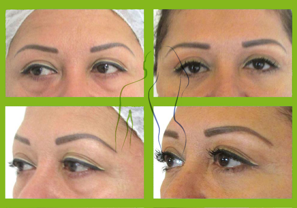 facial2
