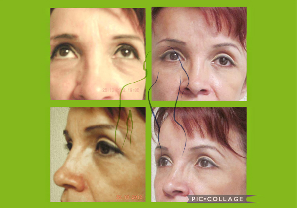 facial3